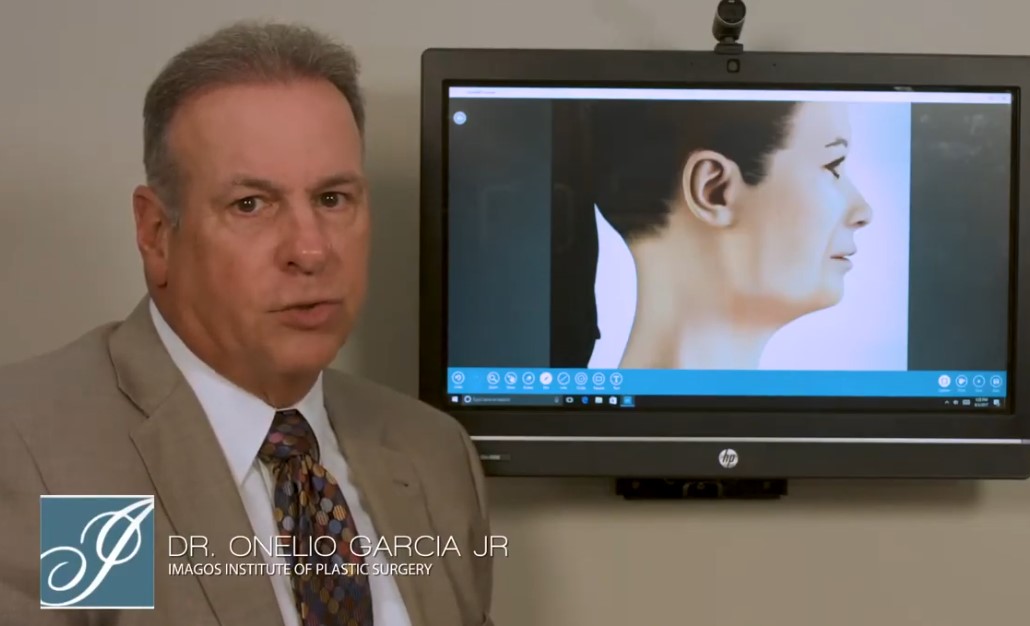 Dr. Garcia talking about facelifts