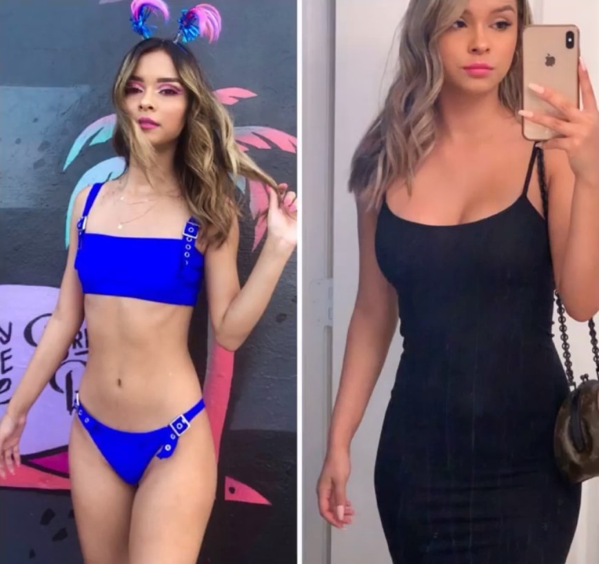 before and after surgery at Imagos Institute of Plastic Surgery