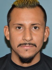After rhinoplasty male patient front view case 5252