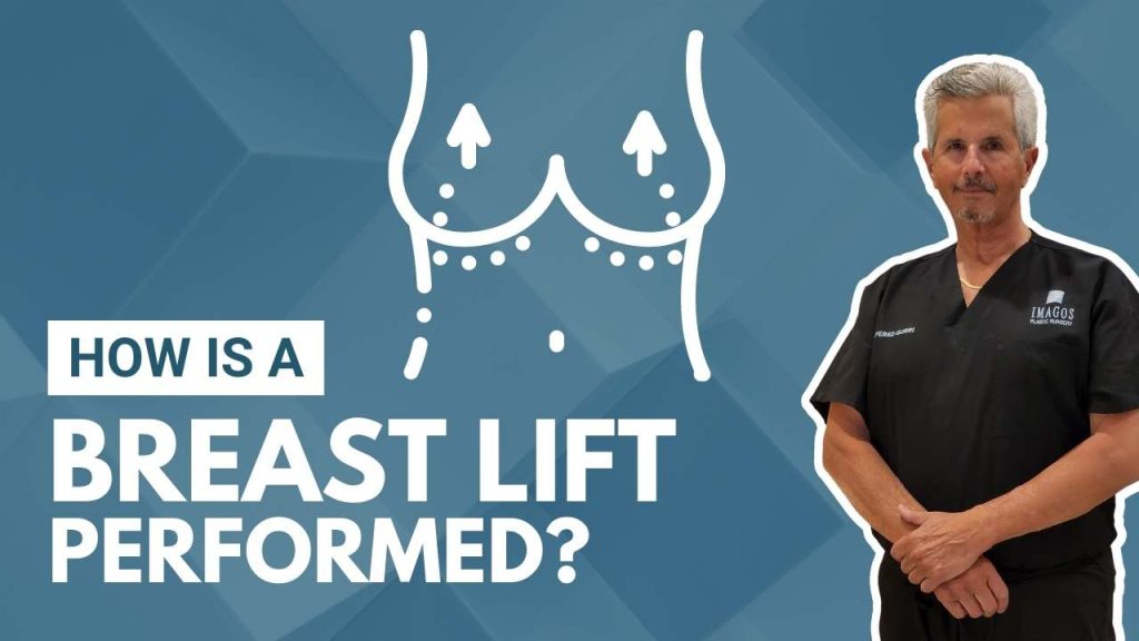 How is a breast lift performed? Miami board certified plastic surgeon explaining how a breast lift is done.