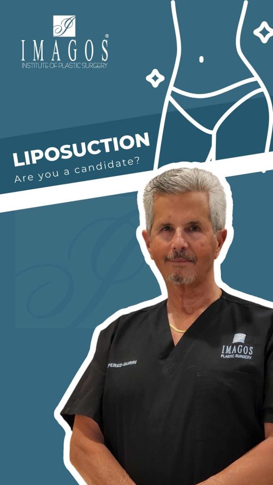 Are you a candidate for liposuction?