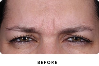 B&A Both Sets (1) (1)-min