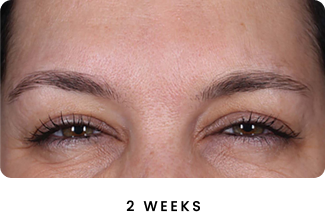 B&A Both Sets (1) (1)