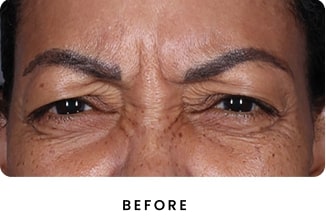 B&A Both Sets (1) (4) (1)-min