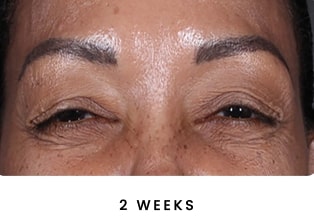B&A Both Sets (1) (5)-min