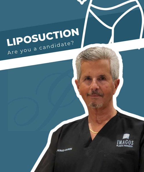 Are you a candidate for liposuction?